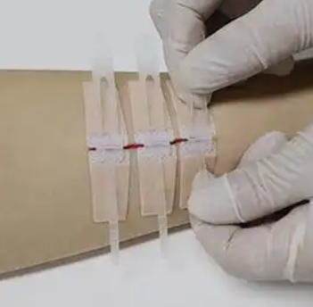 一次性使用免縫閉合器wz-Ⅰ-28